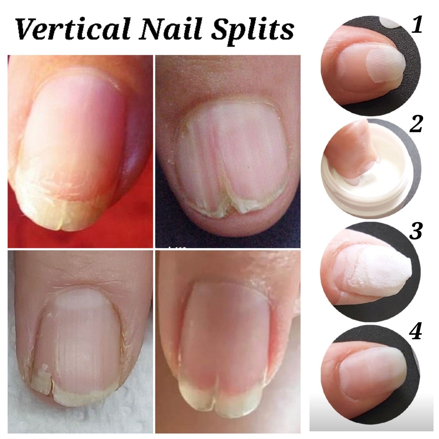 Extra Strong nail treatment -made In USA, nail repair set, effective  fingernail & toenail health care