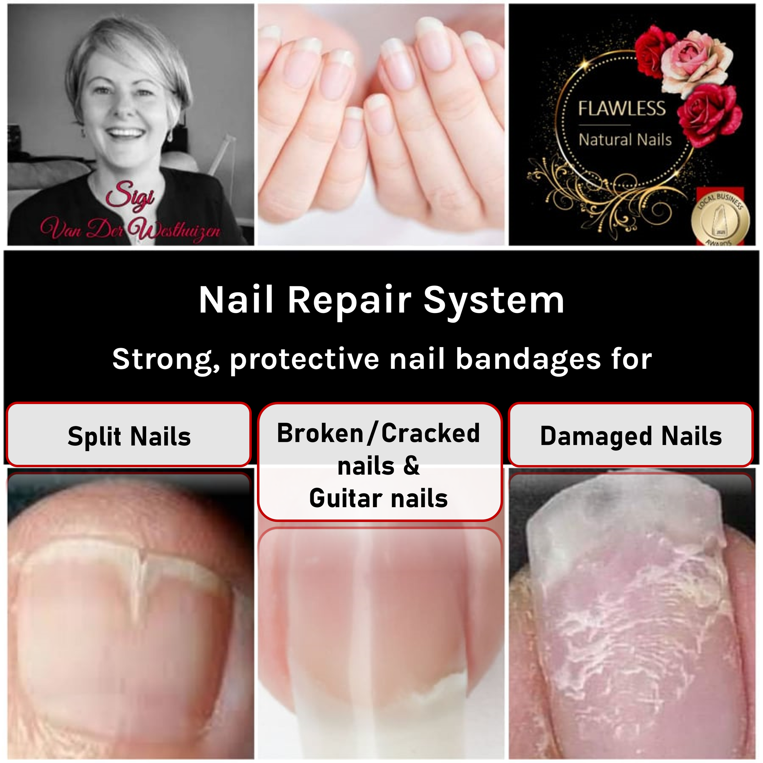 Fix deals split nail